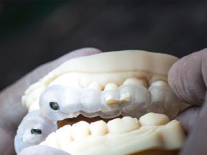 3d printing applications in dental processing