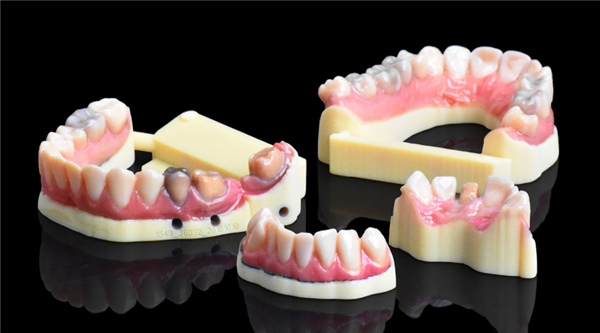 Realistic treatment models produced with the Stratasys J720 Dental 3D Printer.