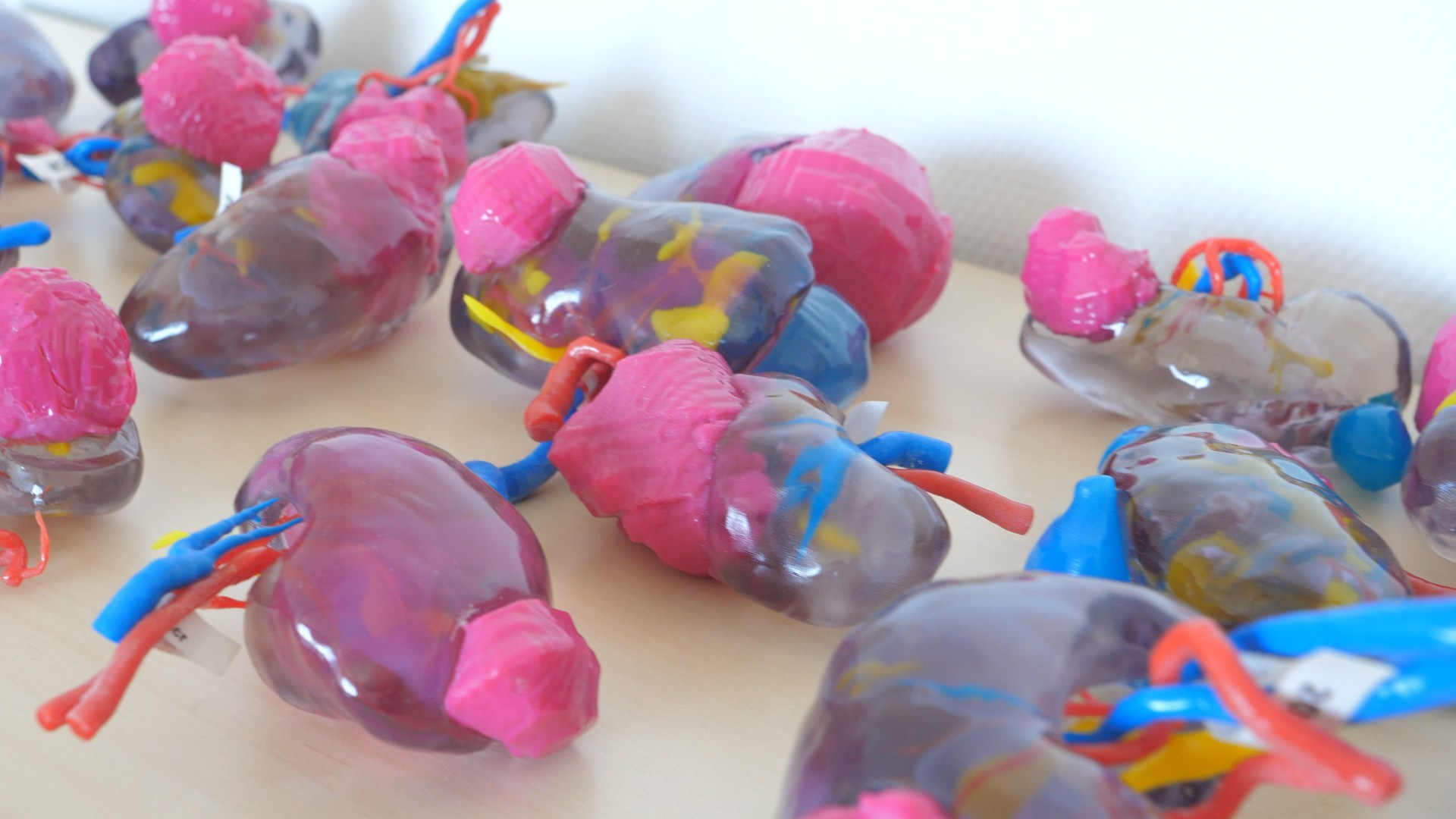 Mô hình quả thận được in 3D