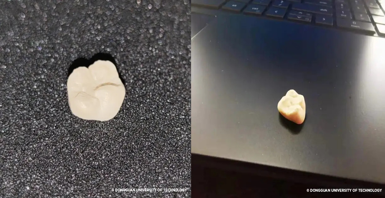 3D Printed Ceramic Teeth Crowns